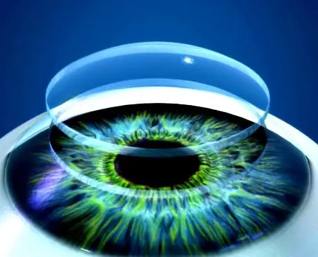 Trapianto di cornea in Tunisia - Cheratoplastica