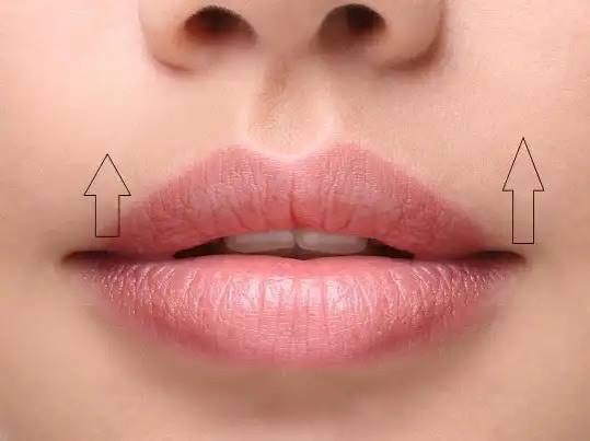 Lip Lift - Trattamento in Tunisia