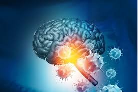 Meningite Tunisia - Diagnosi e trattamento