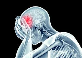 Gestione dei traumi cranici gravi in Tunisia - neurochirurgia